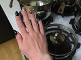 Краснота и зуд на руках