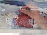 Родились на 27 Неделе. 2Года и 1Месяц!