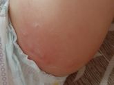 Как думаете это укусы?
