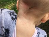 Что за пятнышки??