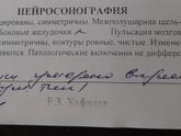 Узи