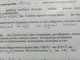 На какой день задержки