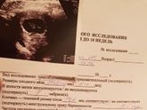 Девочка мальчик?