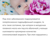 Синдром заходящего солнца