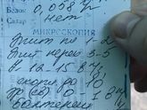 Воспаление левой почки