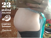 24 ая неделя моно ди двойня