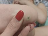 Девочки срочно, тема шипиц