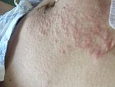 Реанимация 2