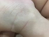 Атоп. Дерматит❌ кто в теме эмолентов , помогите советом
