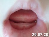 Первый зуб