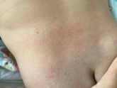 Девочки это аллергия?