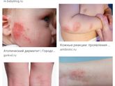Девочки, нужны фото