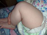 Аллергия или потничка?