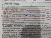 Девочки, подскажите пожалуйста по 2 скринингу!