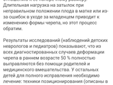 Долихоцефалия у ребенка. Плачу весь день. Девочки подскажите кто сталкивался