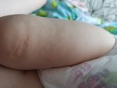 Здравствуйте, что это может