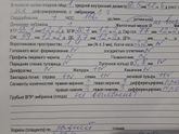 (На память)Узи.