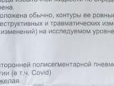 Можно ли делать ингаляции