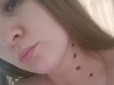 Чувствую запах своего горелого тела 😥