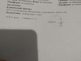 Астигматизм.