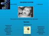 Пришел НИПС 12. Не одно,так другое