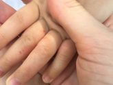 Дерматит у ребёнка чем лечите ?