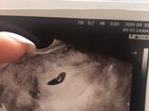 Ох, скорее бы ‘перевалить’ рубеж 7-9 нед!
