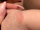 Уважаемые эксперты!!подскажите что это за пятна