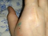 Девочки проснулась от боли