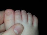 Ноготочки на пальчиках ног