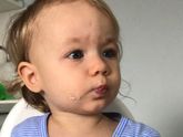 Метопический шов