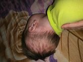 Перестали расти волосы в