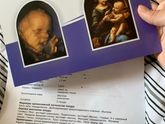 Первый скрининг номер 1)