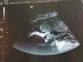 Наши 35 недель ♥ Вторая Б 🤰