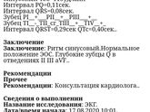 Кто в экг разбирается???