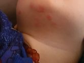 Подскажите,Что это может быть?ребёнку
