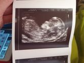 12 недель 2 дня🥰🥰🥰