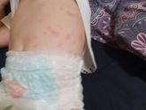 Девочки SOS Подскажите, может