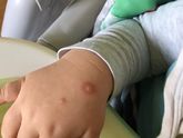 Несколько дней назад у