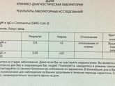 Ковид
