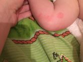 Может у кого из малышей такое было