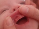Девчонки,подскажите на десне точечки