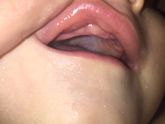 Зубы?
