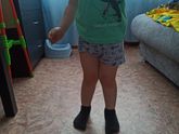 Ноги иксом?