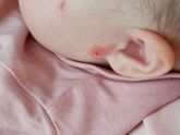 Сменили смесь - стало хуже, что делать?