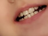 Коронки на зубы у