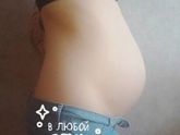 Прилегание плода по передней стенки или требую успокоения моей головы ???