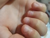 Руки, витамины ,ногти грызет