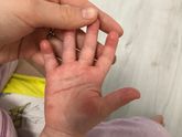 Мамы аллергичных деток, зайдите пож ((