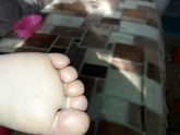 что это может быть. на ногах и руках. больше не где нет